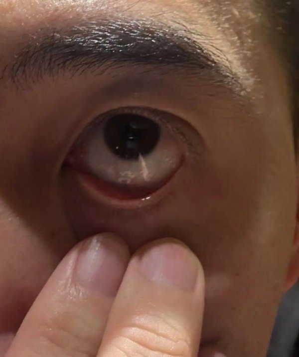 创利配资 知名五星级酒店客房冰箱氨气泄漏，致客人眼角膜受伤半夜躲阳台，酒店回应